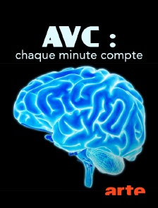 Arte - AVC : chaque minute compte