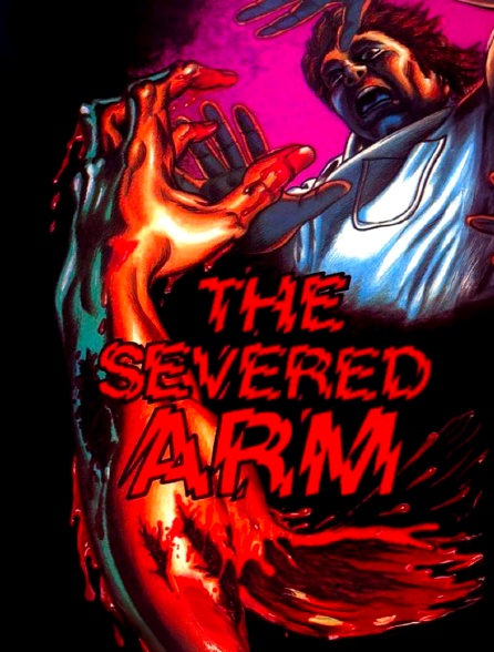 The Severed Arm